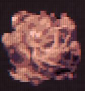 Tumor